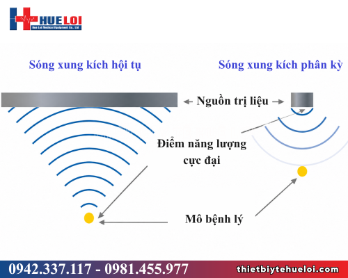 Máy sóng xung kích hội tụ áp điện PIEZONIA