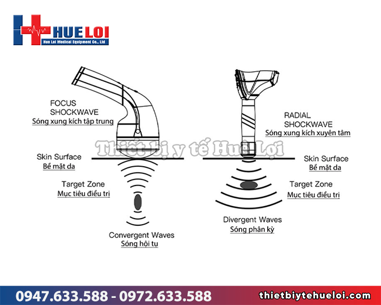 phân biệt sóng xung kích hội tụ và phân kỳ