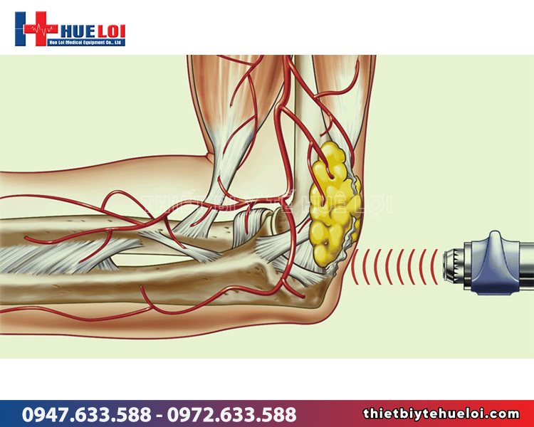 tổng quan về máy xung kích