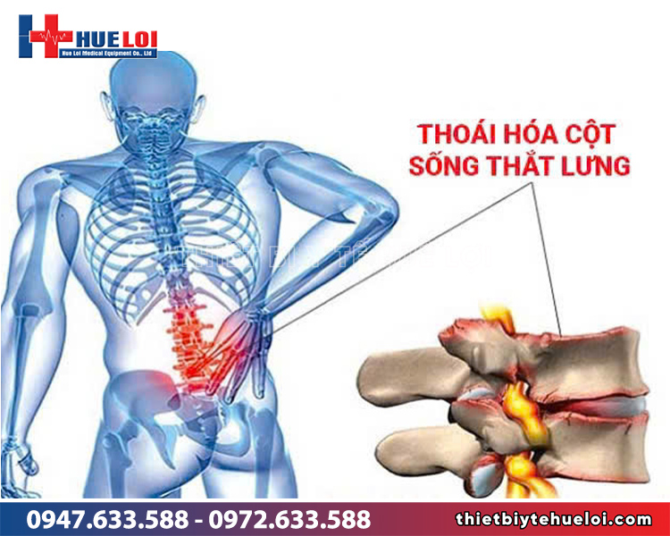 những ai nên dùng giường kéo dãn cột sống