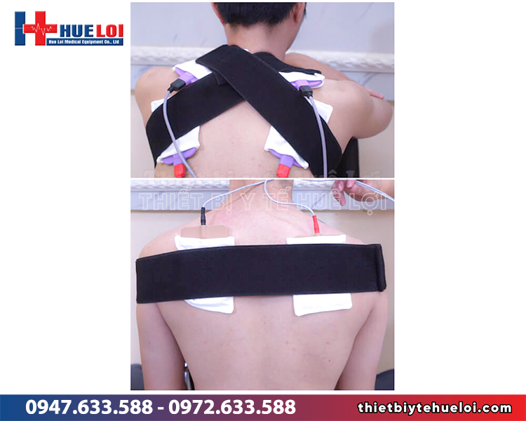 nguyên lý hoạt động của máy điện xung
