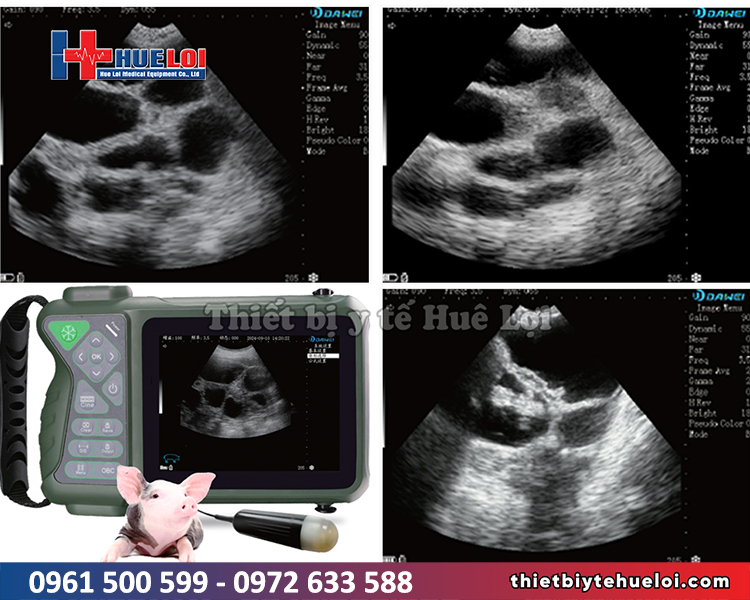 hình ảnh siêu thai cho lợn