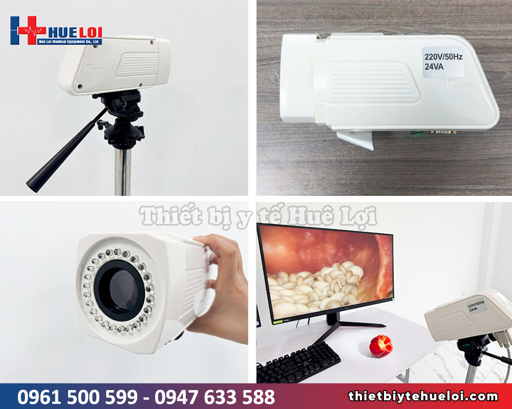 máy soi cổ tử cung chất lượng sd