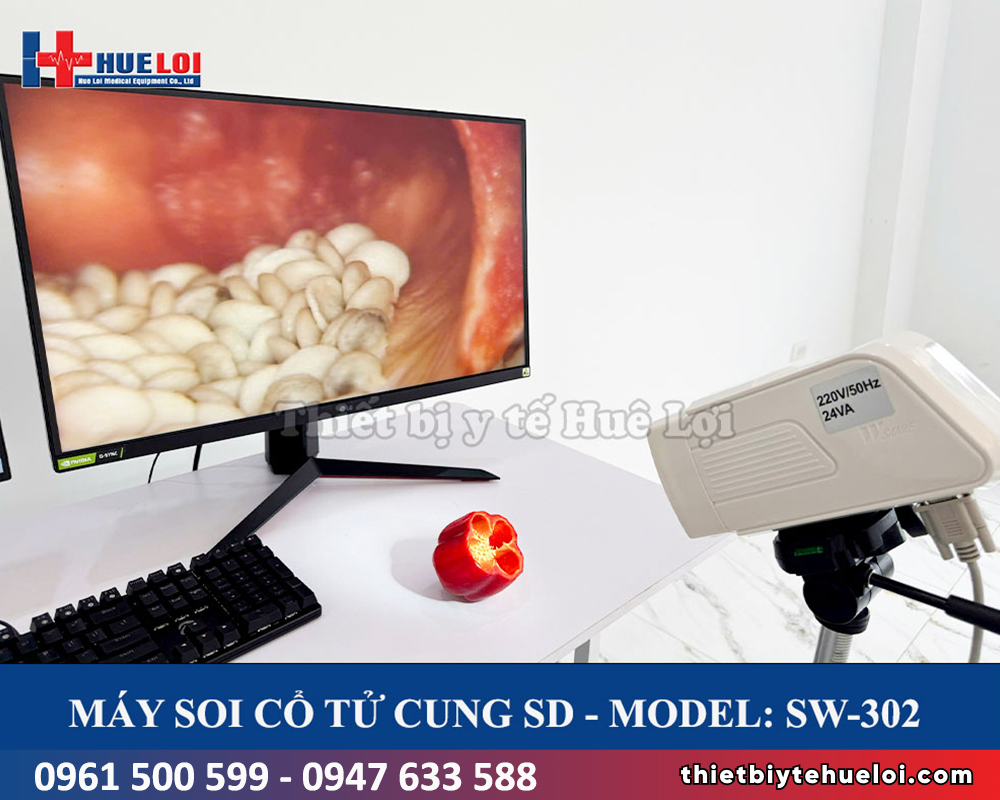 máy soi cổ tử cung rõ nét