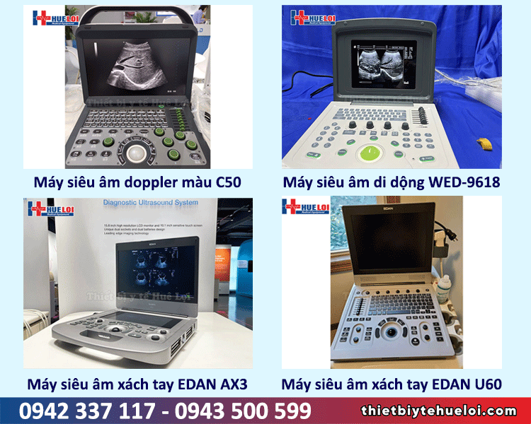 máy siêu âm xách tay chính hãng giá tốt cho phòng khám