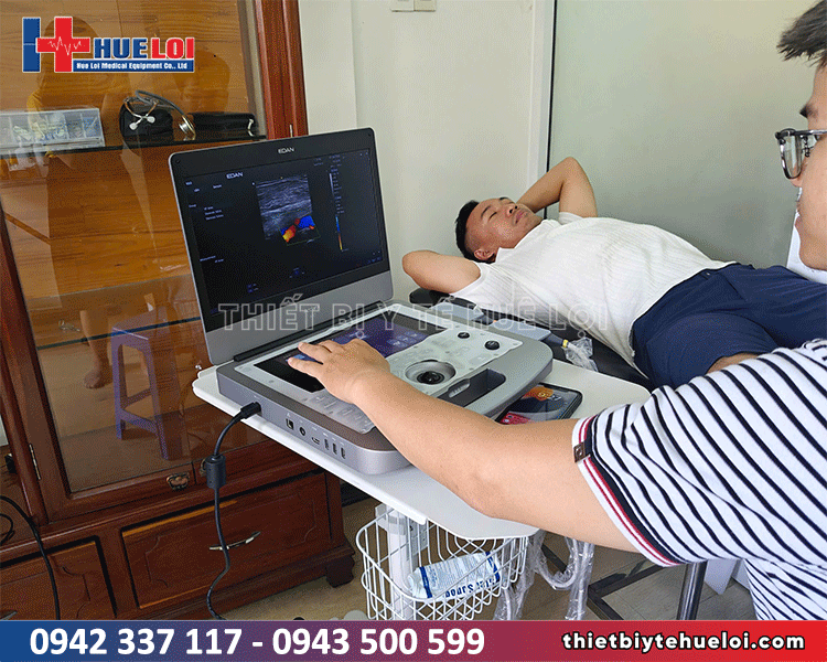máy siêu âm tim mạch giá rẻ