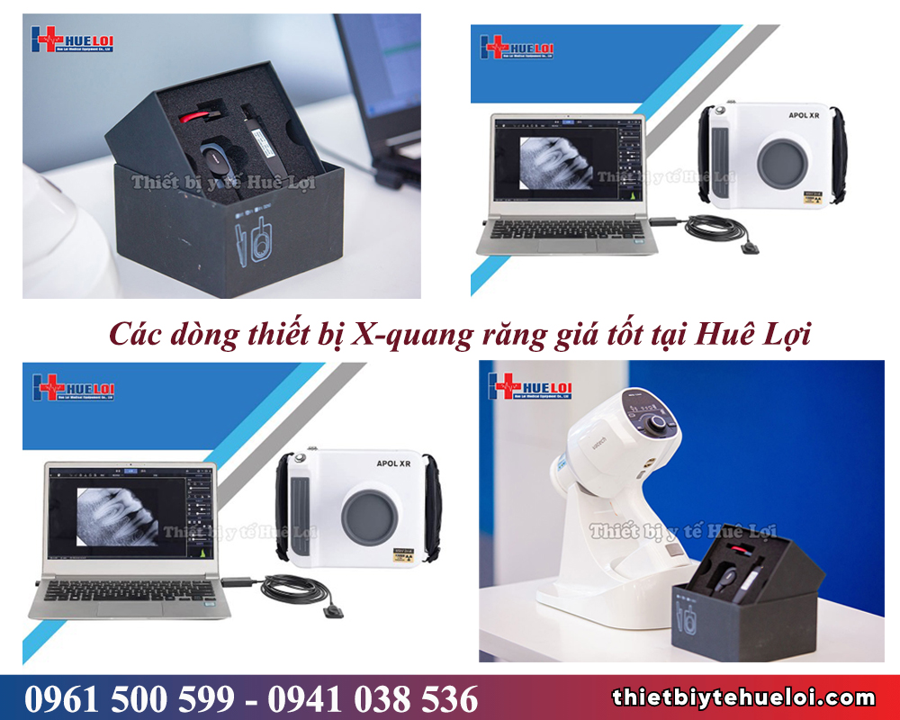 các dòng X-quang răng giá tốt tại huê lợi
