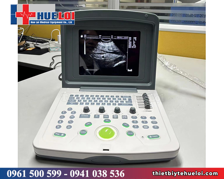 máy siêu âm phòng khám thú y giá rẻ