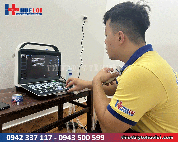 máy siêu âm di động có chất lượng hình ảnh ổn định