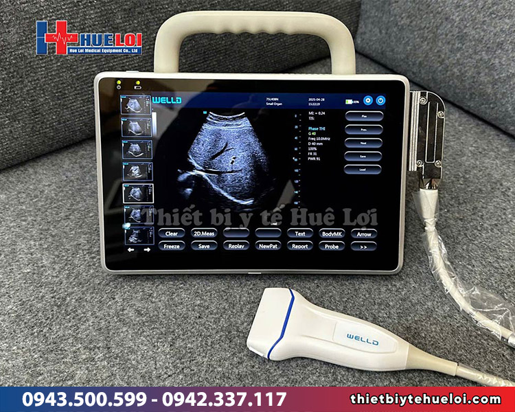 máy siêu âm di động gọn nhẹ