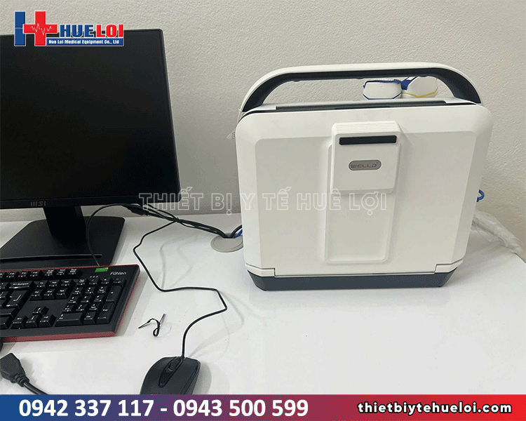 máy siêu âm xách tay nhỏ gọn