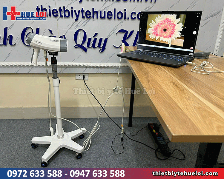 máy nội soi cổ tử cung cho phòng khám