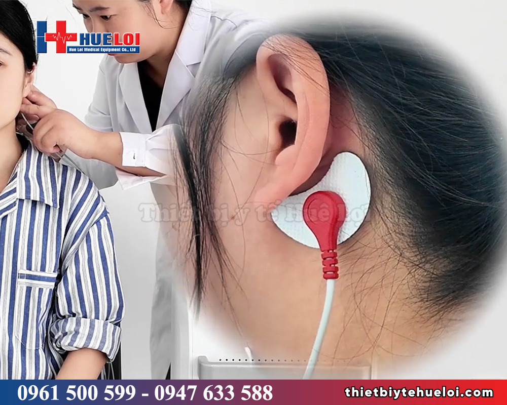 thiết bị kích thích từ xuyên sọ