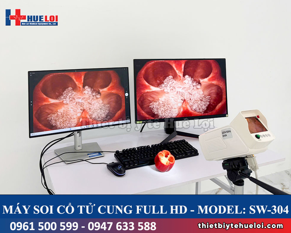 máy soi cổ tử cung full hd