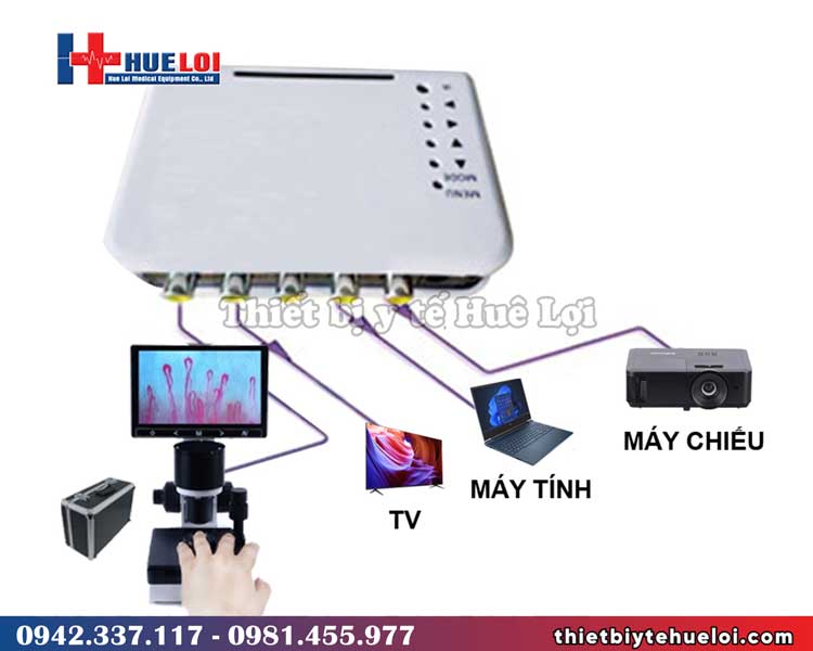 các thiết bị kính soi mạch dn-880 có thể kết nối